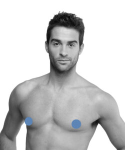 Depilación Areolas - Hombre