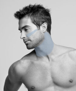 Depilación Pack Cuello + Perfilado Barba