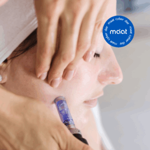 Limpieza Facial y ADN de Salmón con Dermapen