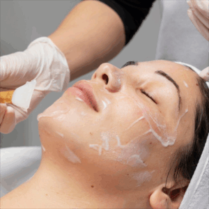 Pack 3 Sesiones Peeling Glycolico