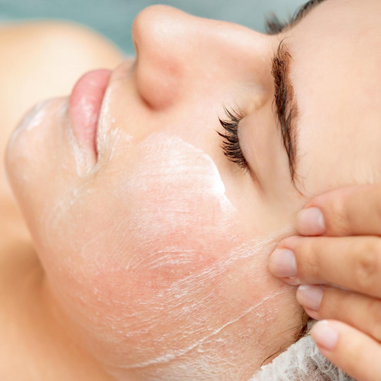 Pack 3 Sesiones Peeling Mandélico