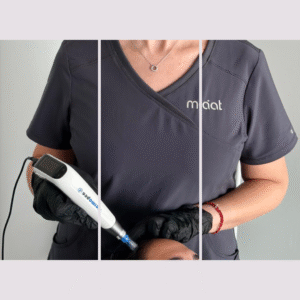Pack 3 Mesoterapia Capilar Exogrow